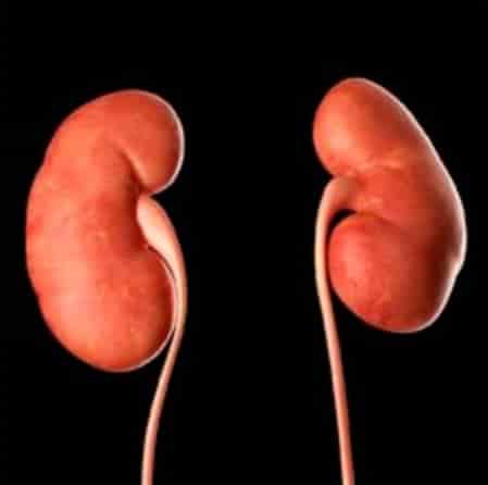 Kidney Problems & Stone